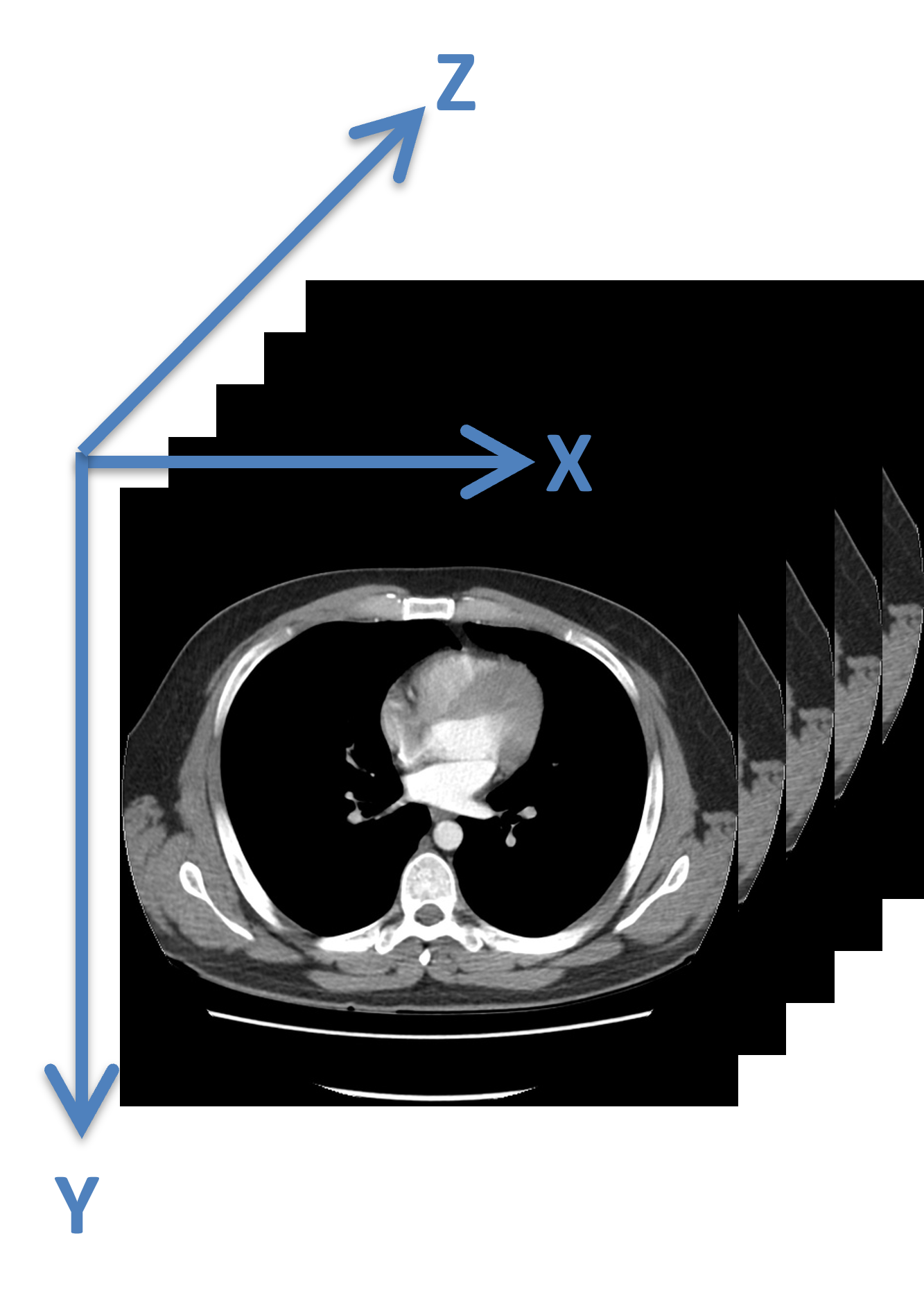 A coordinate system assited to a 3D volume