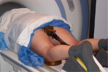 A transrectal ultrasound in MRI suite