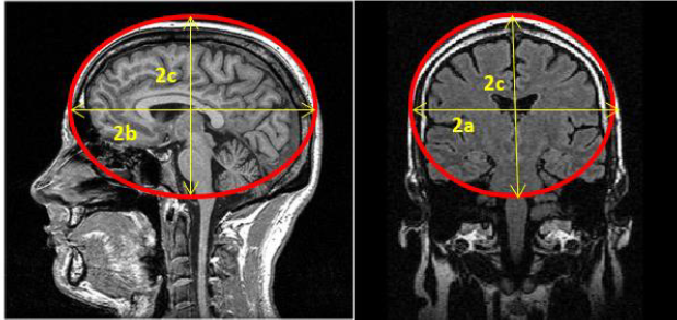 Sphere and ellipsoid to determine sizing.