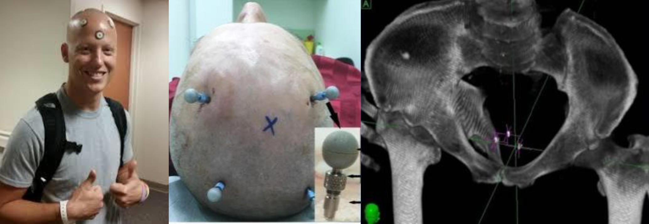 Use case for reference frame